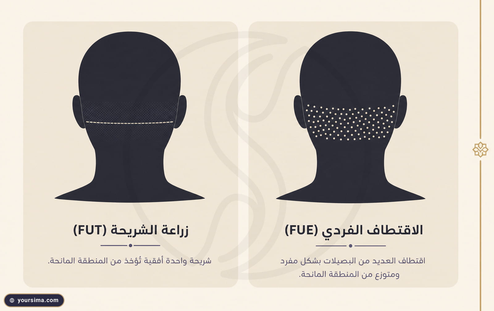 رسم بياني يقارن النقاط المتناثرة لندبات الاقتطاف الفردي بالخط الأفقي الممتد لندبة زراعة الشريحة على المنطقة المانحة