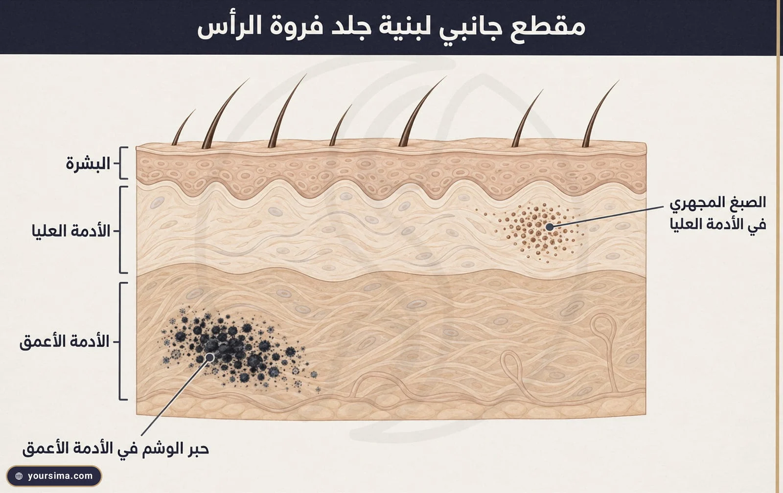 مقطع جانبي لجلد فروة الرأس يقارن موضع صبغة الصبغ المجهري في الأدمة العليا بموضع حبر الوشم في الأدمة الأعمق